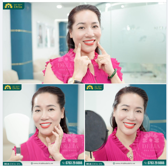 Một nụ cười khỏe - đẹp có ý nghĩa như thế nào trong cuộc sống?