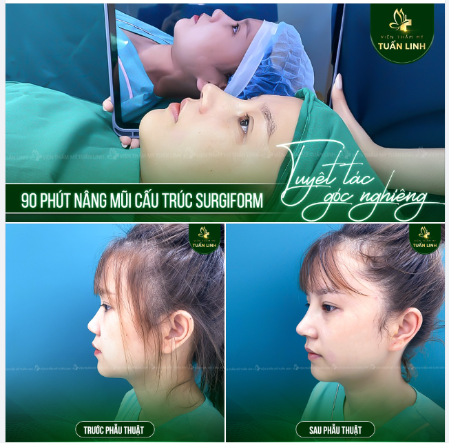 KIẾN TẠO GÓC NGHIÊNG ĐẸP TỰ NHIÊN SAU 90 PHÚT!!