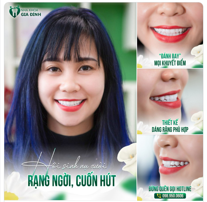 ĐIỀU GÌ CŨNG CÓ THỂ KỂ CẢ LÀM RĂNG SỨ THẨM MỸ