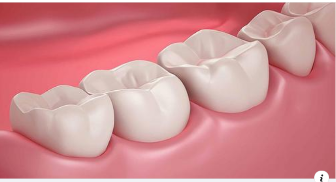 Trám Răng Có Cần Chích Thuốc Tê Không?