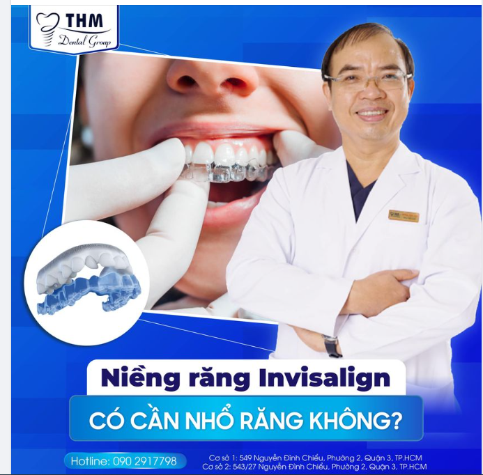 INVISALIGN CÓ CẦN NHỔ RĂNG KHÔNG