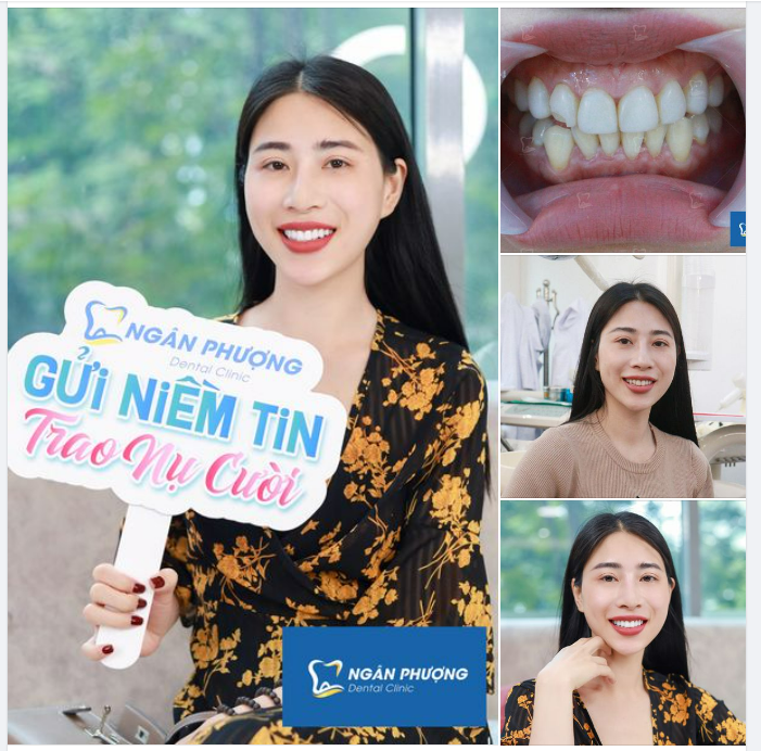 Thay mới nụ cười, gấp mười xinh đẹp
