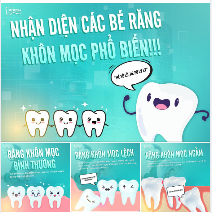 NHẬN DIỆN CÁC BÉ RĂNG KHÔN MỌC PHỔ BIẾN!!!
