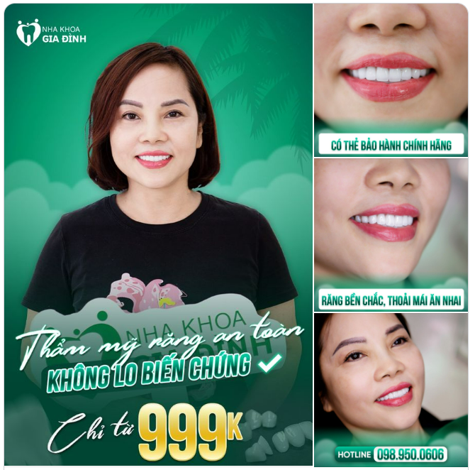 THẨM MỸ RĂNG AN TOÀN - KHÔNG LO BIẾN CHỨNG