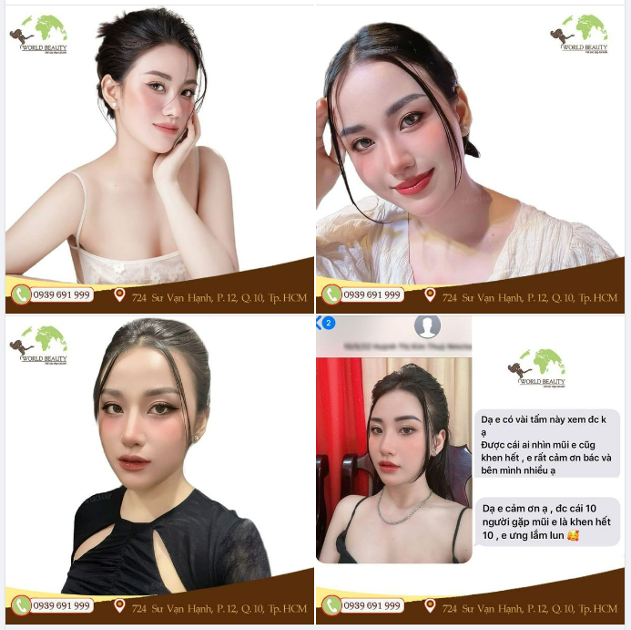 10 người khen hết 10 về kết quả mũi sau 1 năm nâng cấp là có thật