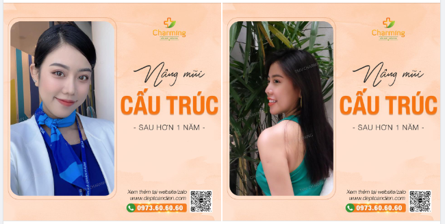 Áo xanh, áo đỏ, chứng tỏ em xinh Nay lại thêm chiếc mũi cấu trúc sụn sườn, cắt cánh, cắt xương bác Khanh làm cho em thì xinh lại càng thêm xinh.