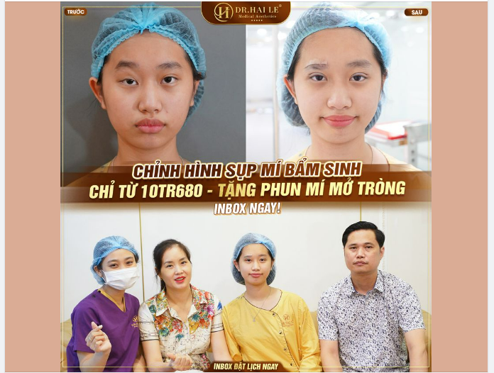 Sụp mí bẩm sinh không chỉ gây ám ảnh về tâm lý mà còn khiến người mắc tự ti về ngoại hình của mình, ngại giao tiếp với xã hội.