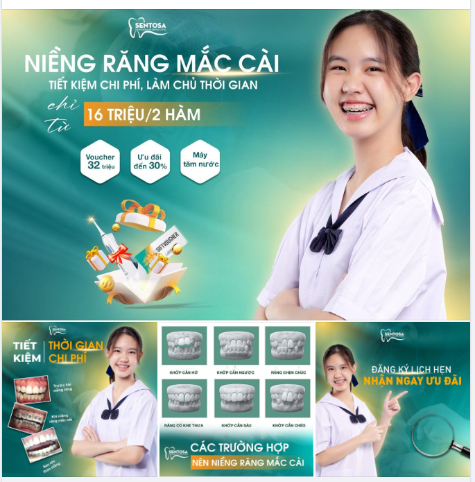 NIỀNG RĂNG MẮC CÀI TIẾT KIỆM CHI PHÍ-LÀM CHỦ THỜI GIAN