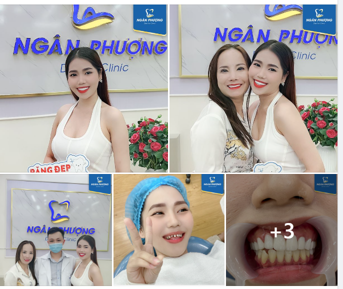 Thay răng đổi vận, chúc mừng ca sĩ Lan Vy đã có cuộc “lột xác” thành công với nụ cười răng sứ mới.