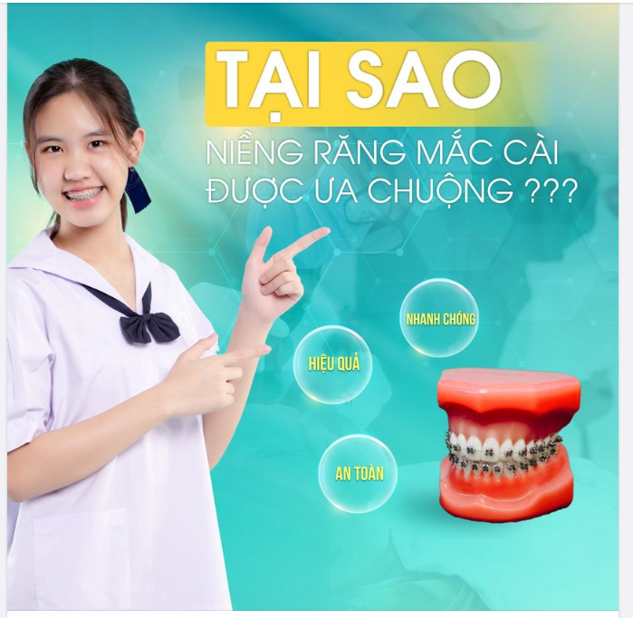 TẠI SAO NIỀNG RĂNG MẮC CÀI LUÔN ĐƯỢC ƯA CHUỘNG
