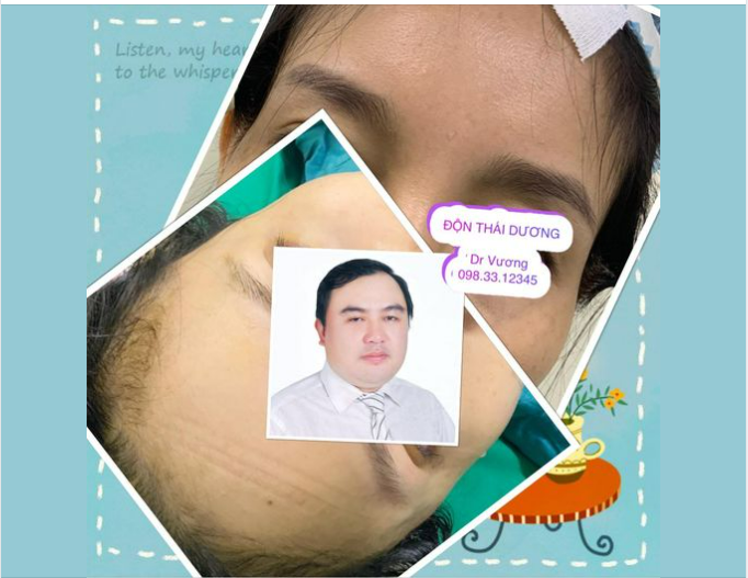 Độn thái dương với Dr Vương