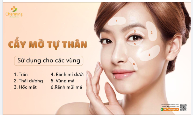 VÌ SAO BẠN CẦN CẤY MỠ MẶT?