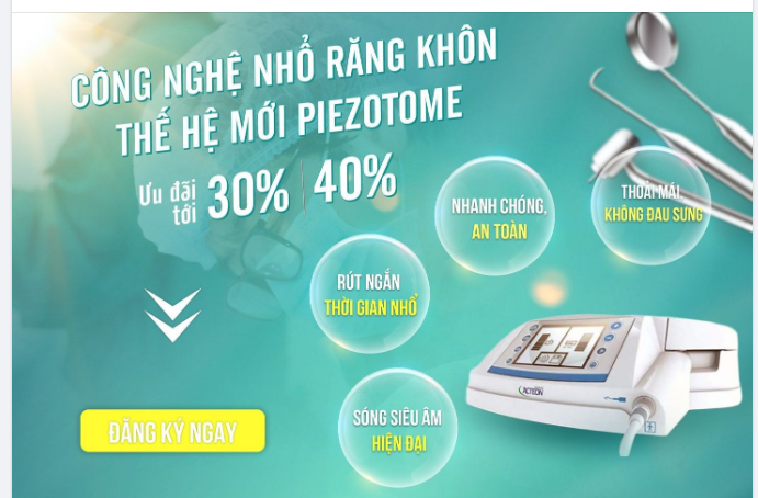 CÔNG NGHỆ NHỔ RĂNG KHÔN THẾ HỆ MỚI PIEZOTOME