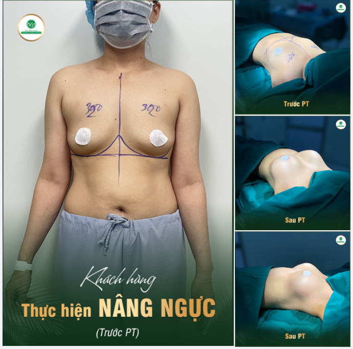 VÒNG 1 "PHỔNG PHAO" - KHIẾN BAO NÀNG MƠ ƯỚC!