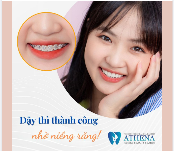 DẬY THÌ THÀNH CÔNG NHỜ NIỀNG RĂNG!