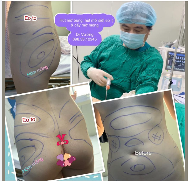 Kiến tạo thân hình SIÊU MẪU với Dr Vương 