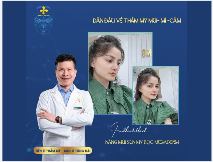Kết quả sau gần 3 tháng nâng mũi, cả nhà thấy thế nào ạ?