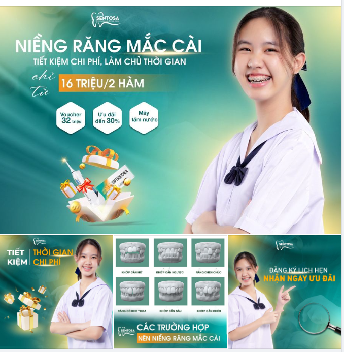 NIỀNG RĂNG MẮC CÀI TIẾT KIỆM CHI PHÍ-LÀM CHỦ THỜI GIAN
