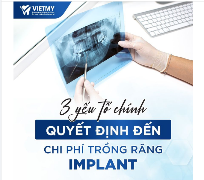 MÁCH NHỎ VỚI BẠN 3 YẾU TỐ QUYẾT ĐỊNH ĐẾN CHI PHÍ TRỒNG RĂNG IMPLANT
