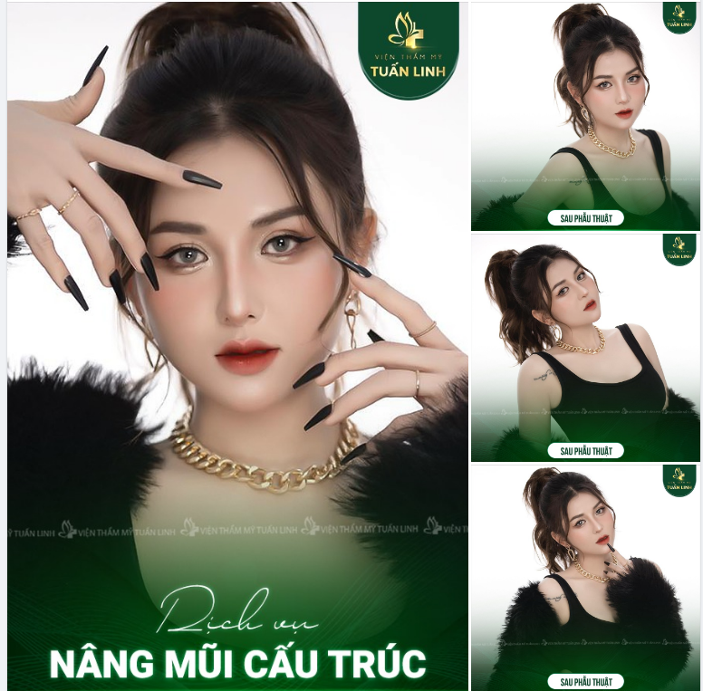 Khách nâng mũi cấu trúc nhà Tuấn Linh có xứng đáng 1 triệu tym ​​​​​​​không ạ??