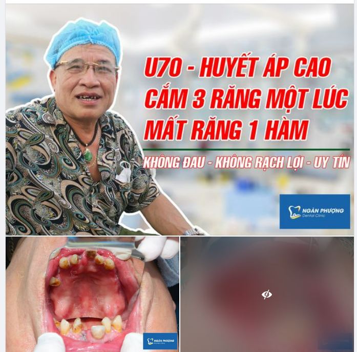 Cảm ơn chú Bùi Quang Dũng đã tin tưởng và lựa chọn bác sĩ Giang, Nha khoa Ngân Phượng.