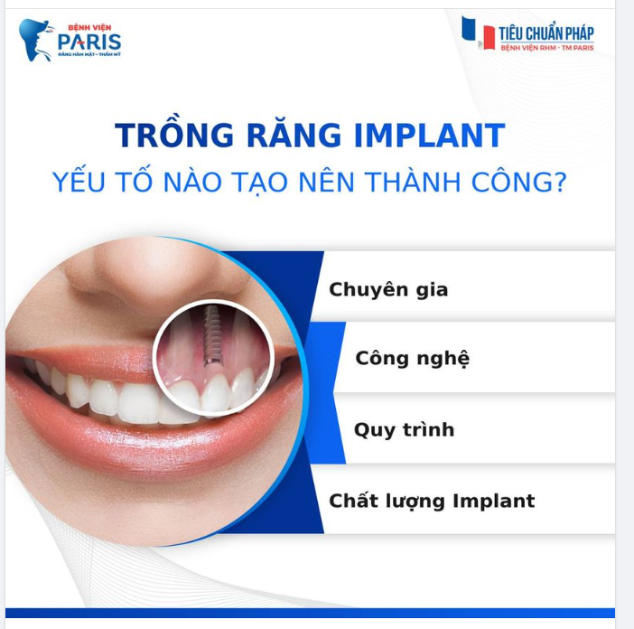 4 YẾU TỐ TẠO NÊN THÀNH CÔNG CỦA 1 CA CẤY GHÉP IMPLANT
