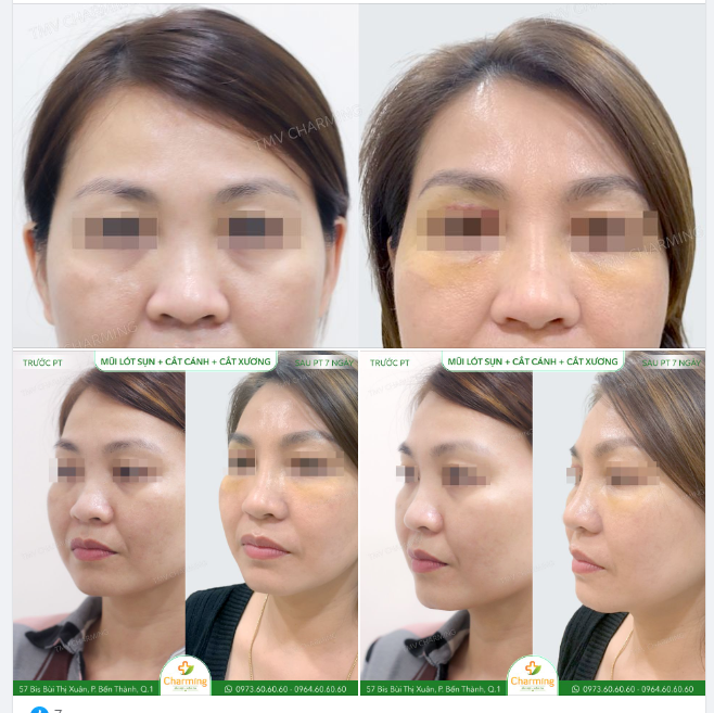 Có những thay đổi tưởng chừng rất nhỏ nhưng thật ra đã trải qua rất nhiều sự biến chuyển lớn.
