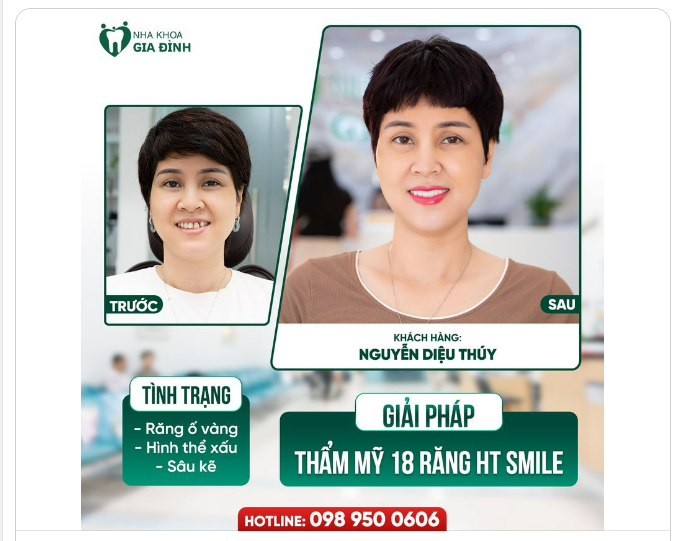 CHỌN MỘT CHI TIẾT THAY ĐỔI ĐỂ RẠNG RỠ, TỰ TIN HƠN, BẠN SẼ CHỌN CHI TIẾT NÀO?