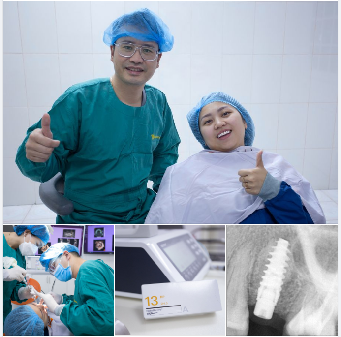 Thực hiện cấy implant cho chị Ngọc đến từ Nam Từ Liêm- Hà Nội.