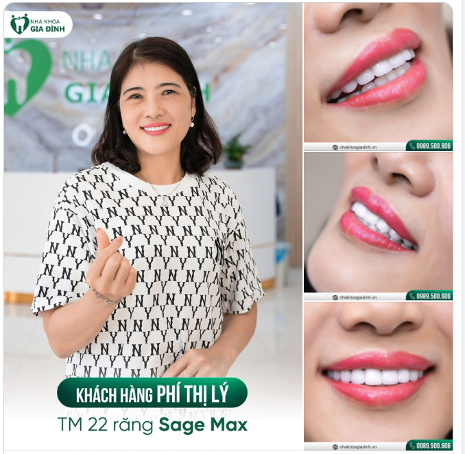 NỤ CƯỜI RẠNG RỠ - XÓA BỎ TỰ TI