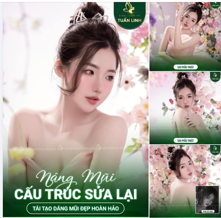 Để ảnh khách xinh Nâng mũi sửa lại tại Tuấn Linh cho chị em ngắm, khi nào đủ say đắm thì INBOX nha!