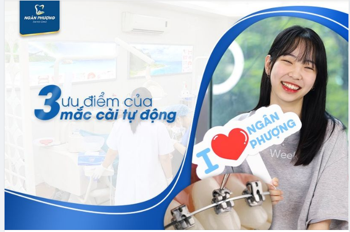 3 ưu điểm giúp MẮC CÀI TỰ ĐỘNG chiếm được trái tim đồng niềng