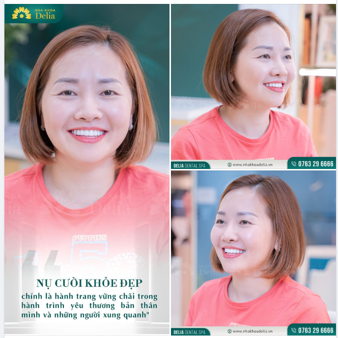 Mến chúc chị Thanh Thủy với nụ cười sứ mới khỏe đẹp sẽ luôn thật tự tin, hạnh phúc và lan tỏa tình yêu thương đến mọi người xung quanh