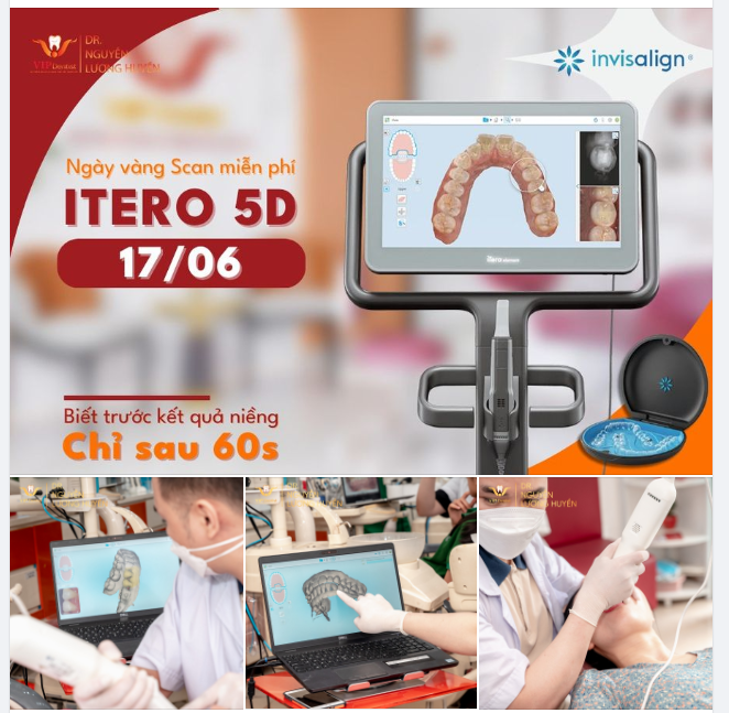 SCAN ITERO 5D - ỨNG DỤNG CÔNG NGHỆ AI 4.0 TRONG CHỈNH NHA TẠI VIP DENTIST