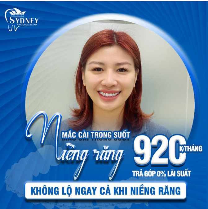 Niềng răng mắc cài trong suốt chỉ 920k/tháng