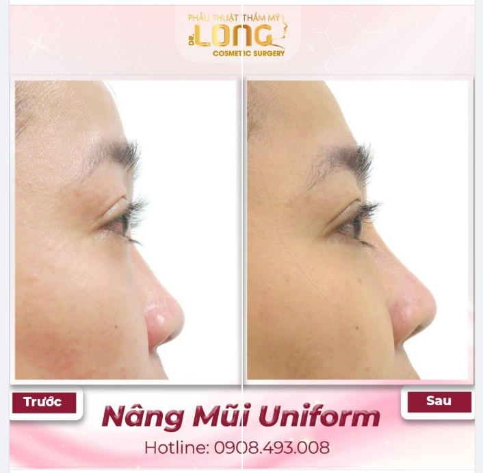 ĐOÁN XEM KHÁCH HÀNG NÓI GÌ SAU KHI ĐẾN BÁC SĨ LONG LÀM ĐẸP