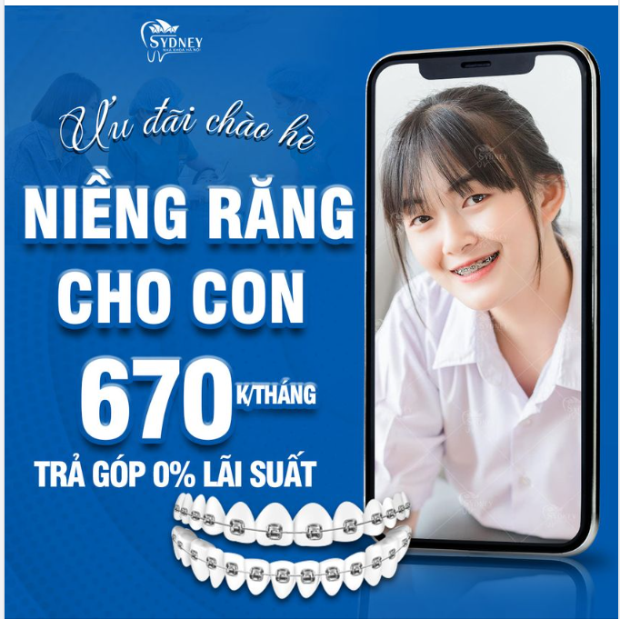Thời điểm vàng để niềng răng là đây chứ đâu!