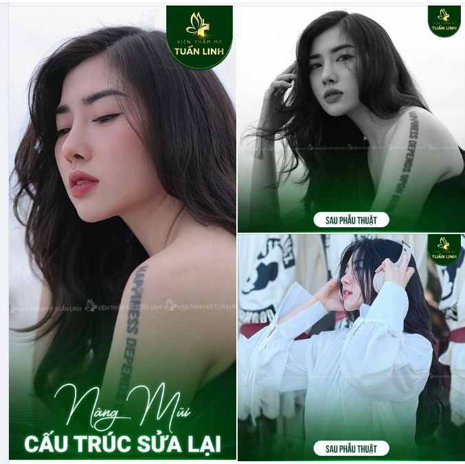 Tự Nhiên - Cân Đối - Hài Hòa - Sang Trọng DÁNG MŨI PHÙ HỢP VỚI TỔNG THỂ GƯƠNG MẶT CHÍNH LÀ DÁNG MŨI ĐẸP NHẤT.