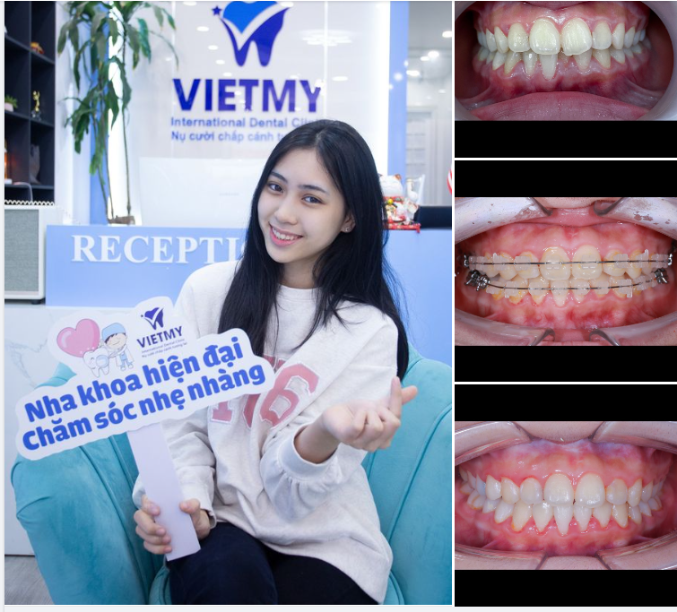 Tái sinh lại nụ cười tươi sáng rạng ngời