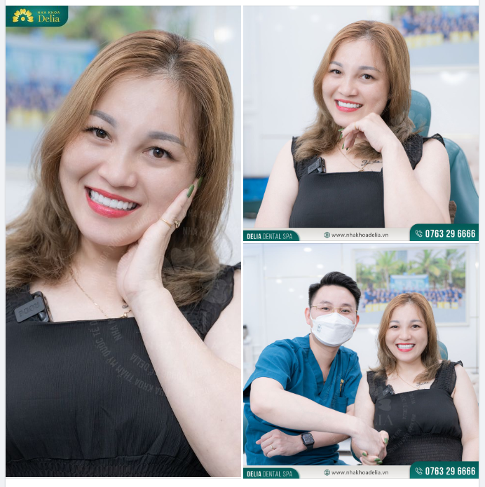 Chị Dương Thị Xuân (kiều bào Đài Loan) chia sẻ sau khi làm thẩm mỹ 18 răng sứ Lava Plus tại Delia.