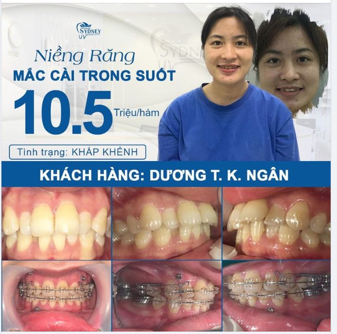 Thì ra lãng mạn không phải thời tiết mùa hè,
