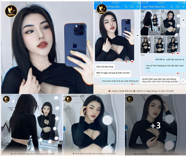 FEEDBACK CỰC “CHÁY” SAU 14 NGÀY COMBO NÂNG MŨI + NÂNG NGỰC