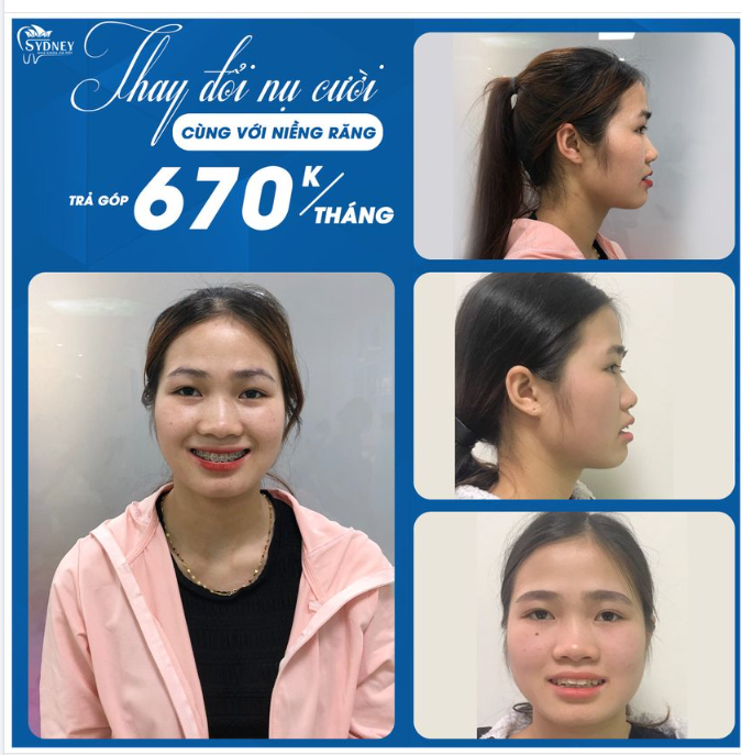 Có phải bạn đang tự ti về góc nghiêng của mình?