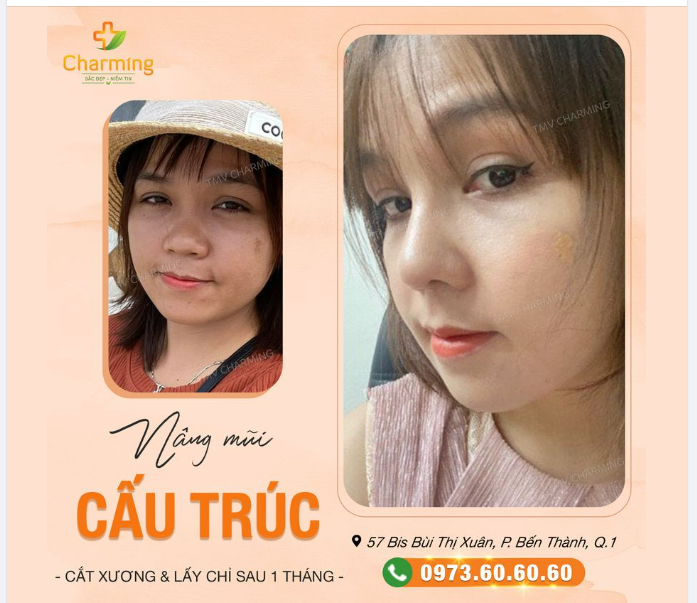 Thật sự là khi nhìn vào hai tấm ảnh này, Charming cảm nhận được niềm hạnh phúc ngập tràn.