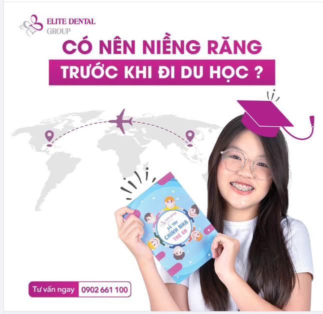 Có nên niềng răng trước khi đi du học? Lời khuyên từ chuyên gia chỉnh nha