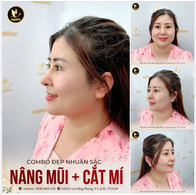 COMBO ĐẸP NHUẬN SẮC
