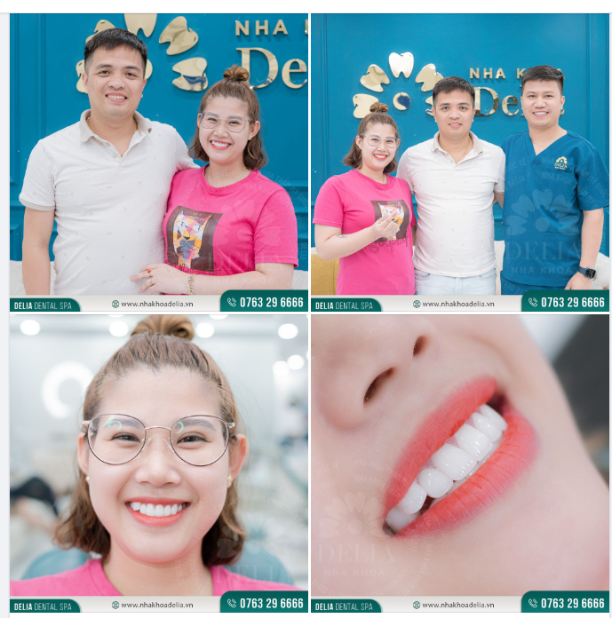 Vợ thẩm mỹ răng sứ, chồng làm răng implant - Còn gì tuyệt vời hơn khi làm đẹp cũng có chồng đồng hành cùng mọi người nhỉ?