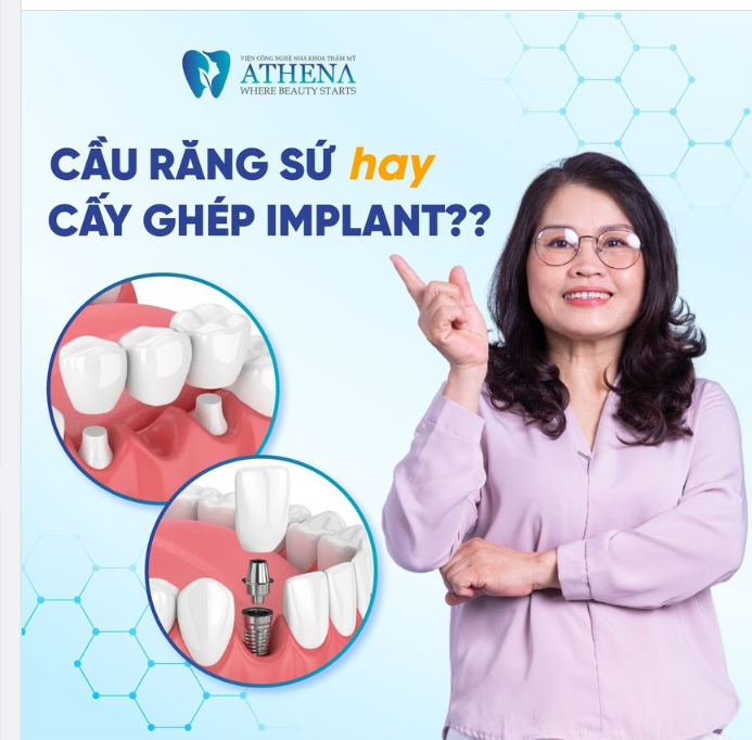 CẦU RĂNG SỨ HAY CẤY GHÉP IMPLANT