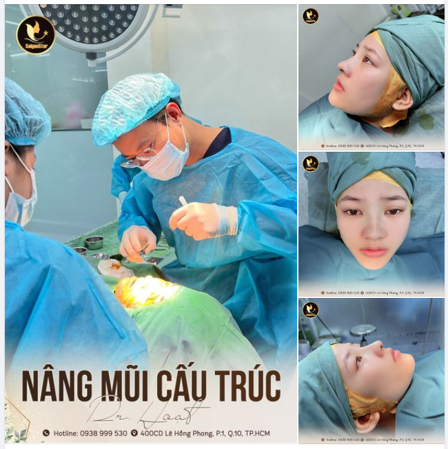 CÔNG THỨC SỞ HỮU DÁNG MŨI TỰ NHIÊN CHỈ TRONG 60 PHÚT ​​​​​​​ NÂNG MŨI CẤU TRÚC DR. HOẠT