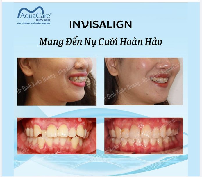 HÃY BẮT ĐẦU NGÀY MỚI BẰNG MỘT NỤ CƯỜI – ĐỂ TỰ MÌNH ĐÁNH DẤU MỘT SỰ KHỞI ĐẦU TỐT ĐẸP